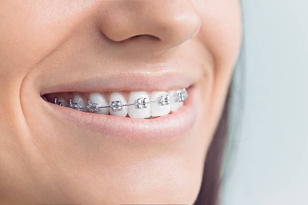 Why Choose Us for Your Dental Needs in Lake City, MN
